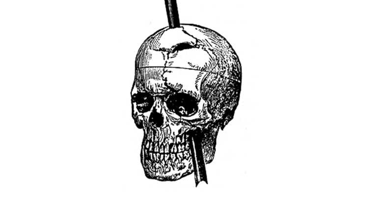 Drawing:6b-Cjghyg-S= Phineas Gage