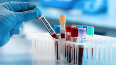 Reliable Laboratory Services for Health Testing