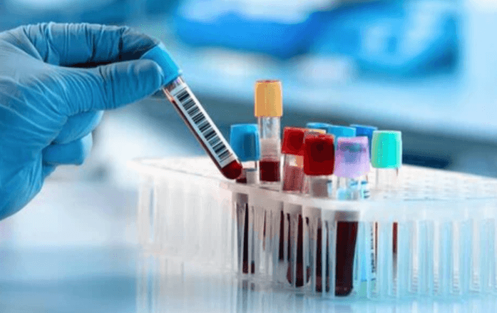 Reliable Laboratory Services for Health Testing